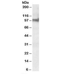 Western blot testing of mouse heart lysate with Plakophilin 2 antibody at 0.3ug/ml. Predicted molecu