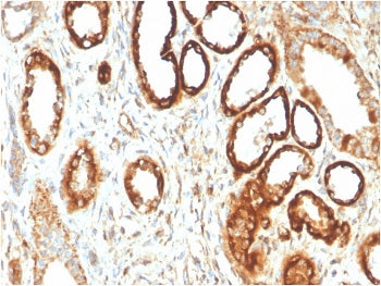 FABP1 Antibody