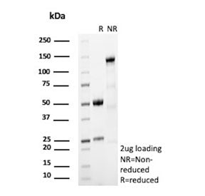 SDS-PAGE analysis of purified, BSA-free FOLH1 antibody (clone FOLH1/2494) as confirmation of integri