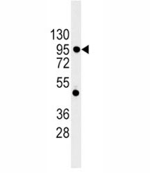 Western blot analysis of E Cadherin antibody and 293 lysate. Expected molecular weight: 135 kDa (pre