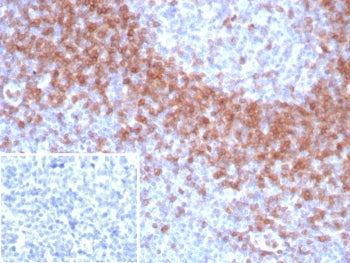 IHC staining of FFPE human tonsil tissue with IgD antibody (clone IGHD/8367R). Inset: PBS used in pl