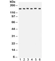Western blot testing of 1) rat brain, 2) rat liver, 3) human HeLa, 4) CEM, 5) A549 and 6) MCF7 lysat