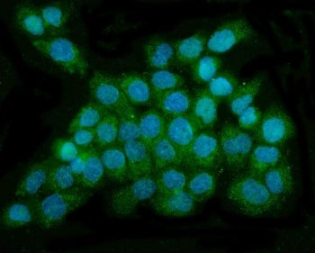 Immunofluorescent staining of FFPE human A431 cells with DNAJC6 antibody (green) and DAPI nuclear st