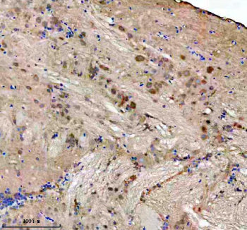 Immunohistochemical analysis of FHL2a/b protein using Zebrafish Fhl2 antibody, HRP secondary and DAB