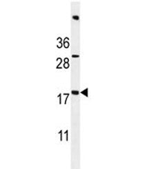 ACN9 antibody western blot analysis in mouse bladder tissue lysate. Predicted molecular weight ~15 k
