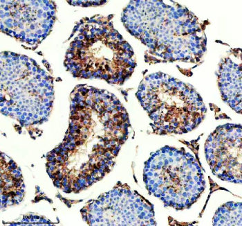 Immunohistochemical staining of IQCM using anti-IQCM antibody. IQCM was detected in a paraffin-embed