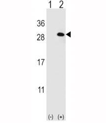 Western blot analysis of EIF4E2 antibody and 293 cell lysate (2 ug/lane) either nontransfected (Lane