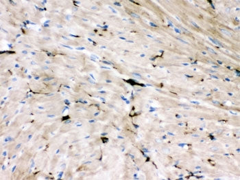 IHC testing of FFPE rat heart tissue with GAP43 antibody. HIER: steamed with pH6 citrate buffer, HRP