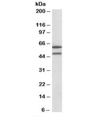IL13RA2 Antibody