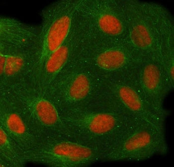 Target of EGR1 protein 1 Antibody / TOE1