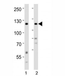 Ror2 Antibody