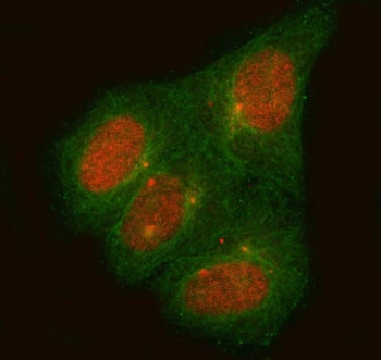 PPP1R36 Antibody / C14orf50