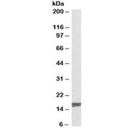 Western blot testing of human breast cancer lysate with TSPO antibody at 0.1ug/ml. Predicted molecul
