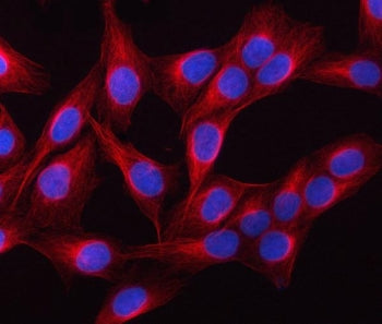 Immunofluorescent staining of FFPE human U-2 OS cells with TUBB1 antibody (red) and DAPI nuclear sta