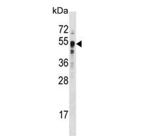 Western blot testing of human MCF7 cell lysate with SETD7 antibody. Predicted molecular weight ~41 k