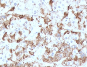 IHC testing of FFPE human pituitary tissue with PRL antibody (clone PLCN-1). Required HIER: boil tis