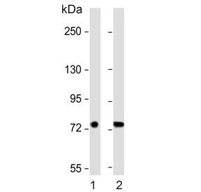 Western blot testing of human 1) breast and 2) lung lysate with SLC6A14 antibody. Predicted molecula