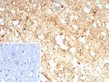 IHC staining of FFPE human brain tissue with GLUL antibody (clone rGLUL/8621). Inset: PBS used in pl