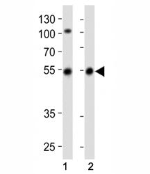 Western blot analysis of lysate from (1) SH-SY5Y cell line and (2) human brain tissue lysate using P