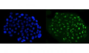 Immunofluorescent staining of FFPE human A431 cells with Nuclear factor 1 B-type antibody (green) an
