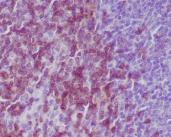 IHC staining of FFPE mouse spleen tissue with CD3e antibody. HIER: boil tissue sections in pH6, 10mM