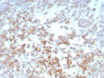 IHC staining of FFPE human tonsil tissue with CD21 antibody (clone CR2/8769R). HIER: boil tissue sec