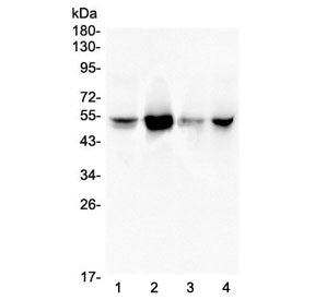 Western blot testing of human 1) A549, 2) Jurkat, 3) HeLa and 4) PANC-1 lysate with RbAp48 antibody 