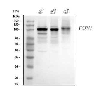Western blot analysis of FOXM1 using anti-FOXM1 antibody. Electrophoresis was performed on a 12% SDS