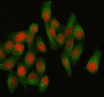 Immunofluorescent staining of FFPE human HeLa cells with HELLS antibody (red) and Beta Tubulin mAb (