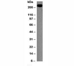 Western blot testing of CD45RB antibody and Daudi lysate. Expected molecular weight: ~147/180-220 kD