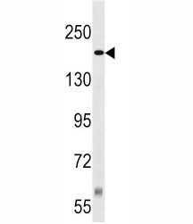 TSC2 Antibody
