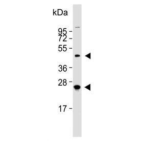 Western blot testing of human MCF7 cell lysate with HABP2 antibody. Predicted molecular weight ~63 k