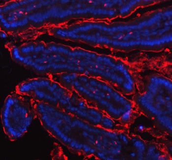 Immunofluorescent staining of MEP1B using anti-MEP1B antibody (red). MEP1B was detected in paraffin-