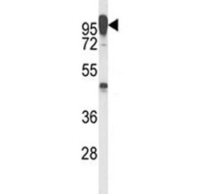 Western blot analysis of anti-LAMP2 antibody and T47D lysate. The protein can be extensively glycosy