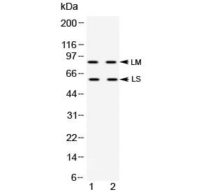 Western blot testing of human 1) HeLa and 2) K562 cell lysate with ADAM28 antibody at 0.5ug/ml. Pred