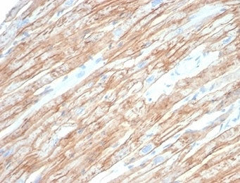 IHC staining of FFPE human heart tissue with DMD antibody (clone DMD/6270). HIER: boil tissue sectio