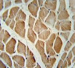 IHC testing of FFPE human skeletal muscle tissue with DAAM1 antibody. HIER: steam section in pH6 cit