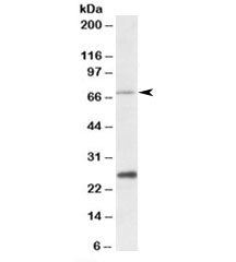 Western blot testing of human liver lysate with CPT2 antibody at 1ug/ml. Predicted molecular weight: