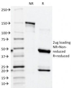 PSAP Antibody / Prostate Specific Acid Phosphatase