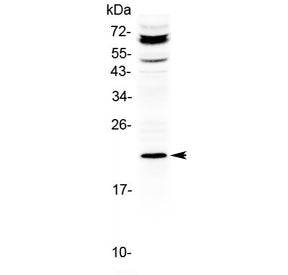 ANGPTL8 Antibody / Betatrophin / C19orf80