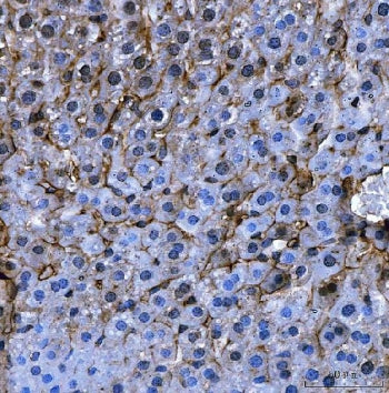 IHC staining of FFPE mouse liver tissue with Angiotensinogen antibody. HIER: boil tissue sections in pH8 EDTA for 20 min and allow to cool before testing.
