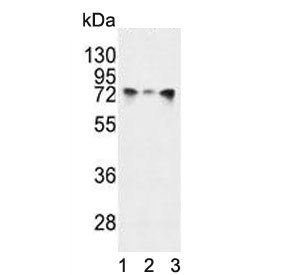Western blot testing of human 1) HeLa, 2) A2058 and 3) NCI-H460 cell lysate with HSPA5 antibody. Pre
