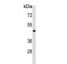 Western blot testing of human T-47D cell lysate with NME7 antibody. Predicted molecular weight ~43 k