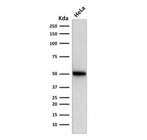 p53 Antibody / TP53