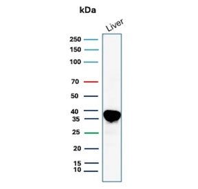 Western blot testing of human liver tissue lysate with Arginase 1 antibody (clone ARG1/9446). Predic