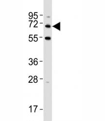 Western blot testing of p62 antibody at 1:500 dilution + HeLa lysate; Predicted band size : 47~62 kD