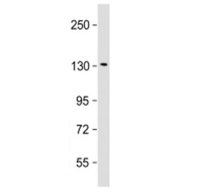 Western blot testing of Klotho antibody at 1:2000 + human HepG2 cell lysate. Predicted molecular wei