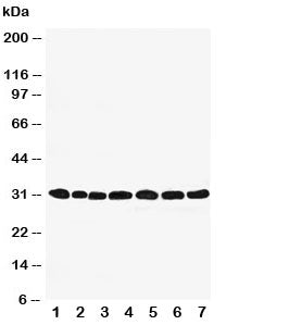 Western blot testing of Peroxiredoxin 4 antibody and Lane 1: rat brain; 2: (r) lung; 3: (r) liver; 4