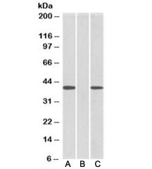 Western blot of HEK293 lysate overexpressing human FANCF-MYC probed with FANCF antibody [0.5ug/ml] i