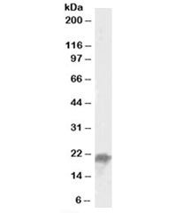 Western blot testing of mouse liver lysate with UBE2F antibody at 0.05ug/ml. Predicted molecular wei